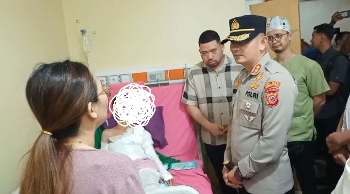 Korban Cairan Alkohol EA Mulai Pulih, Kapolres Ciko Kunjungi Korban Luka Bakar